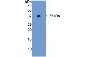Detection of Recombinant LFA1a, Human using Polyclonal Antibody to Lymphocyte Function Associated Antigen 1 Alpha (CD11a) (ITGAL Antikörper  (AA 809-1066))