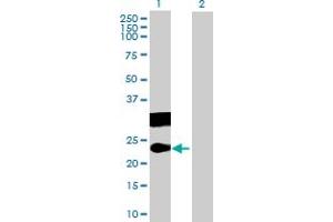 Western Blot analysis of CT45A3 expression in transfected 293T cell line by CT45A3 MaxPab polyclonal antibody. (CT45A3 Antikörper  (AA 1-189))