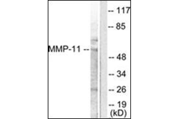 MMP11 Antikörper  (Internal Region)