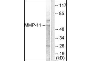 Western blot analysis of extracts from A549 cells, using MMP-11 Antibody. (MMP11 Antikörper  (Internal Region))
