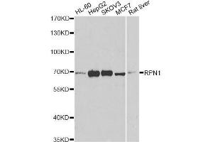 Western blot analysis of extracts of various cell lines, using RPN1 antibody. (RPN1 Antikörper  (AA 20-280))