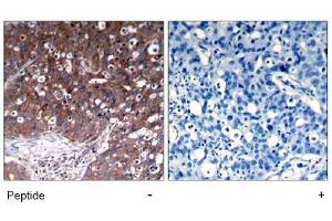 Image no. 1 for anti-Insulin-Like Growth Factor 1 Receptor (IGF1R) (Tyr1280) antibody (ABIN197576) (IGF1R Antikörper  (Tyr1280))