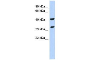 Western Blotting (WB) image for anti-Ankyrin Repeat and SOCS Box Containing 8 (ASB8) (N-Term) antibody (ABIN634410) (ASB8 Antikörper  (N-Term))