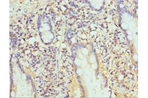 Immunohistochemistry (IHC) image for anti-Proteasome (Prosome, Macropain) Subunit, beta Type, 1 (PSMB1) (AA 1-273) antibody (ABIN7164972)