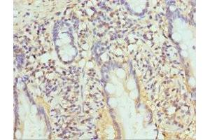 Immunohistochemistry of paraffin-embedded human small intestine tissue using ABIN7164972 at dilution of 1:100 (PSMB1 Antikörper  (AA 1-273))