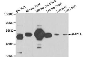 Western blot analysis of extracts of various cell lines, using AMY1A antibody.
