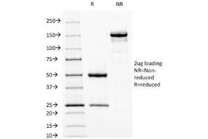 SDS-PAGE Analysis of Purified, BSA-Free Fascin Antibody (clone FSCN1/417). (Fascin Antikörper)