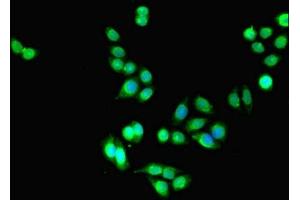 Immunofluorescent analysis of PC-3 cells using ABIN7158230 at dilution of 1:100 and Alexa Fluor 488-congugated AffiniPure Goat Anti-Rabbit IgG(H+L)