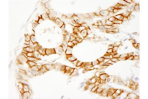 Immunohistochemistry (IHC) image for anti-Catenin, beta (CATNB) (AA 25-75) antibody (ABIN7453663)