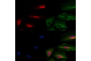ABIN6258459 and ABIN6275835 staining  cells by IF/ICC.