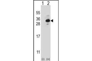 Western blot analysis of CLTB (arrow) using rabbit polyclonal CLTB Antibody (ABIN656850 and ABIN2846055). (CLTB Antikörper)