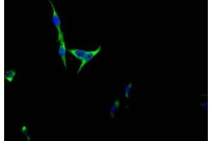 Immunofluorescence staining of HepG2 Cells with ABIN7127489 at 1:50, counter-stained with DAPI. (Rekombinanter FGFR3 Antikörper)