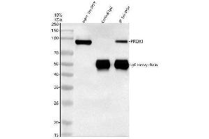 Immunoprecipitating (IP) PROX1 in SH-SY5Y whole cell lysate. (PROX1 Antikörper  (AA 51-737))