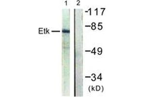 Western Blotting (WB) image for anti-BMX Non-Receptor Tyrosine Kinase (BMX) (AA 6-55) antibody (ABIN2888731) (BMX Antikörper  (AA 6-55))