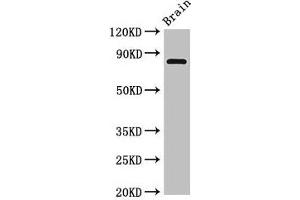 Western Blot Positive WB detected in: Rat brain tissue All lanes: Loxl4 antibody at 4 μg/mL Secondary Goat polyclonal to rabbit IgG at 1/50000 dilution Predicted band size: 85 kDa Observed band size: 85 kDa (LOXL4 Antikörper  (AA 26-757))