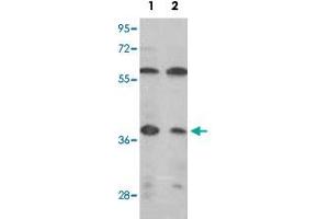 Western blot analysis of IDH3A polyclonal antibody  in (1) MCF-7, (2) Jurkat cell line lysates (35ug/lane). (IDH3A Antikörper  (C-Term))