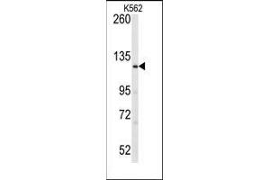 Western blot analysis of anti-LATS1 Antibody (N-term) in K562 cell line lysates (35ug/lane). (LATS1 Antikörper  (N-Term))