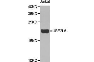 Western blot analysis of extracts of Jurkat cells, using UBE2L6 antibody (ABIN5972395). (UBE2L6 Antikörper)