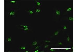 Immunofluorescence of purified MaxPab antibody to SF3B2 on HeLa cell. (SF3B2 Antikörper  (AA 1-636))