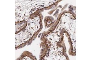 Immunohistochemical staining of human placenta with CXorf15 polyclonal antibody  shows cytoplasmic positivity in trophoblastic cells at 1:1000-1:2500 dilution. (Taxilin gamma (TXLNG) (AA 408-522) Antikörper)