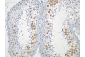 Immunohistochemistry of normal testis (formalin fixed) after antigen retreival, stained with Anti-Mad2L1 (clone 17D10)). (MAD2L1 Antikörper)