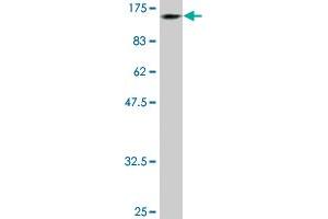 Western Blotting (WB) image for anti-DEAD/H (Asp-Glu-Ala-Asp/His) Box Polypeptide 11 (DDX11) (AA 1-970) antibody (ABIN514945)