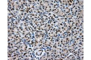 Immunohistochemical staining of paraffin-embedded Carcinoma of liver tissue using anti-CYP1A2 mouse monoclonal antibody. (CYP1A2 Antikörper)