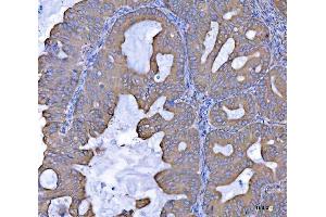 IHC analysis of SEPT7/SEPTIN7 using anti-SEPT7/SEPTIN7 antibody (ABIN7599301).