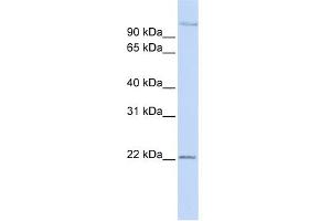 WB Suggested Anti-PDS5B Antibody Titration: 0. (PDS5B Antikörper  (Middle Region))