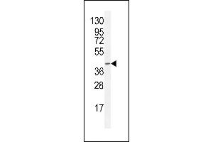 F8A2 Antibody (N-term) (ABIN655340 and ABIN2844904) western blot analysis in CEM cell line lysates (35 μg/lane). (F8A2 Antikörper  (N-Term))