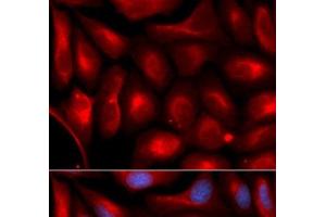 Immunofluorescence analysis of U2OS cells using PSMA5 Polyclonal Antibody (PSMA5 Antikörper)