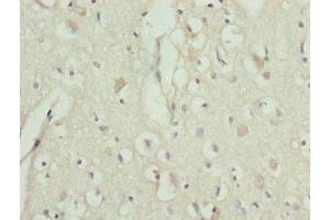 Immunohistochemistry of paraffin-embedded human brain tissue using ABIN7151242 at dilution of 1:100 (TRIM13 Antikörper  (AA 40-310))
