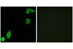 Immunofluorescence analysis of A549 cells, using RPS20 antibody. (RPS20 Antikörper  (Internal Region))