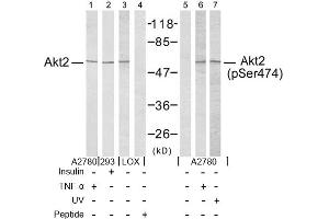 Image no. 2 for anti-V-Akt Murine Thymoma Viral Oncogene Homolog 2 (AKT2) (Ser474) antibody (ABIN197358) (AKT2 Antikörper  (Ser474))