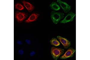 ABIN6260452 and ABIN6278012 staining Hela cells by IF/ICC. (Calpain S1 Antikörper  (Internal Region))