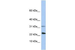 WB Suggested Anti-EXOSC3 Antibody Titration:  0.