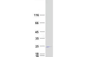 Western Blotting (WB) image for Germinal Center Expressed Transcript 2 (GCET2) (Transcript Variant 2) protein (Myc-DYKDDDDK Tag) (ABIN2721822)