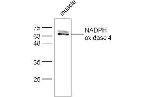 Mouse muscle lysates probed with Rabbit Anti-NADPH oxidase 4 Polyclonal Antibody, Unconjugated  at 1:500 for 90 min at 37˚C. (NADPH Oxidase 4 Antikörper  (AA 81-180))