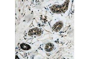 Immunohistochemical analysis of Beta-tubulin staining in human colon formalin fixed paraffin embedded tissue section. (TUBB Antikörper)