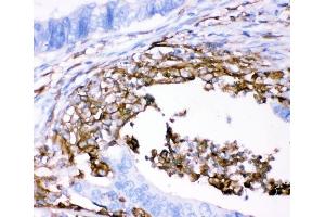 IHC analysis of CD18/ITGB2 using anti-CD18/ITGB2 antibody (ABIN3043260).