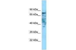 WB Suggested Anti-Golim4 Antibody   Titration: 1. (Golgi Integral Membrane Protein 4 (GOLIM4) (C-Term) Antikörper)