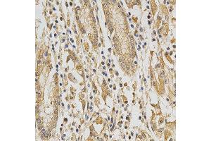 Immunohistochemistry of paraffin-embedded human stomach using DNMT3A antibody at dilution of 1:200 (x400 lens) (DNMT3A Antikörper)