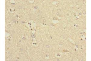 Immunohistochemistry of paraffin-embedded human brain tissue using ABIN7174101 at dilution of 1:100 (PTPN18 Antikörper  (AA 1-210))