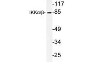 Western blot analysis of IKKα/β antibody in extracts from Jurkat cells. (IKK alpha Antikörper)