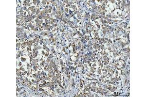 IHC analysis of PPP2R1A using anti-PPP2R1A antibody (ABIN7603081).
