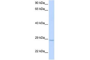 WB Suggested Anti-XRCC2 Antibody Titration: 0. (XRCC2 Antikörper  (Middle Region))