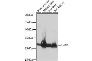 Western blot analysis of extracts of various cell lines using LHPP Polyclonal Antibody at dilution of 1:1000. (LHPP Antikörper)
