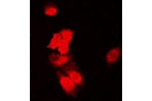 Immunofluorescent analysis of SIAH1/2 staining in HeLa cells. (SIAH1/2 Antikörper  (Center))