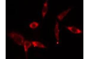 ABIN6275780 staining  293 cells by IF/ICC. (MX2 Antikörper  (Internal Region))