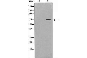 Western blot analysis on Jurkat cell lysate using DCP1A Antibody,The lane on the left is treated with the antigen-specific peptide. (DCP1A Antikörper  (Internal Region))